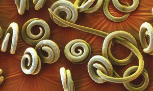 Заражение глистами