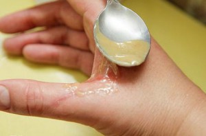 Что делать при термическом ожоге?