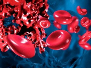 Разжижение крови домашними средствами