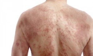 Как проявляется?