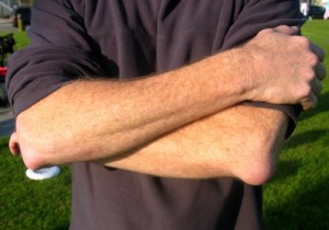 Признаки бурсита локтя