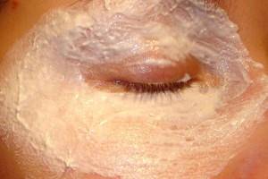 Как удалить липому в домашних условиях?