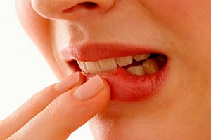 Признаки воспаления десен