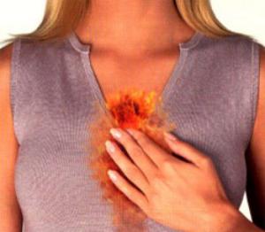 изжога лечение народными средствами