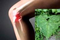 лечение лопухом артроза коленного сустава