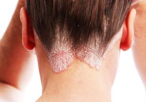 гусиный жир в косметологии