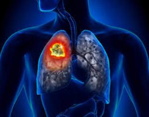 сердечный кашель симптомы