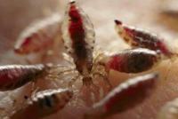 народные средства от вшей