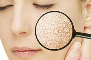 чем заменить можжевеловые ягоды