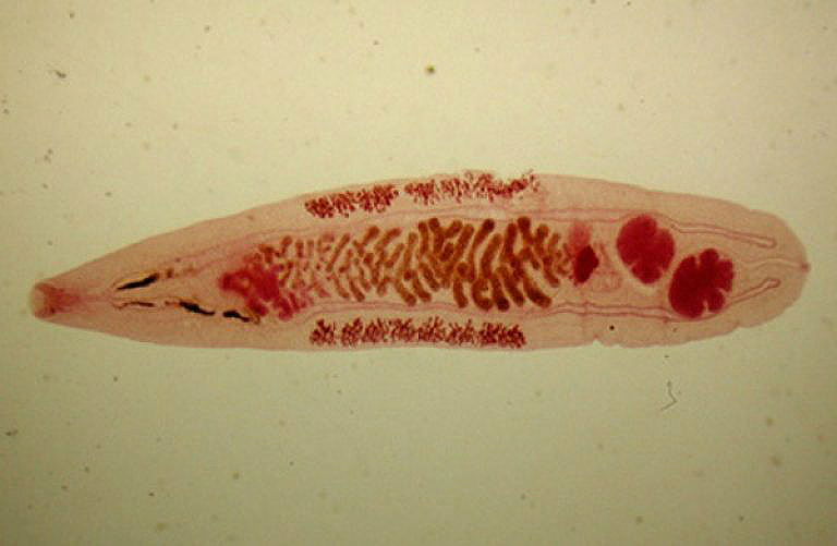 Описторхоз и что нужно знать о нем