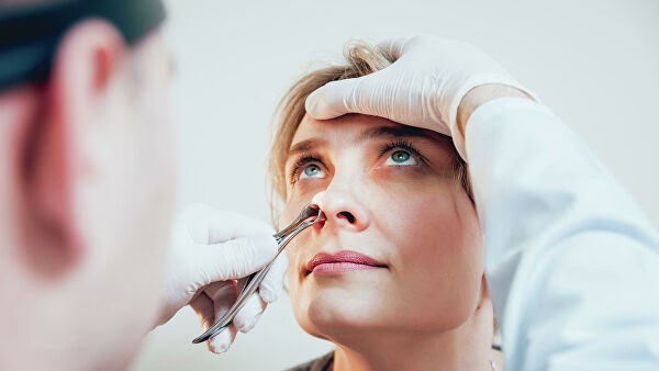 Искривление носовой перегородки