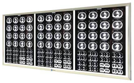 Российский производитель медицинских негатоскопов