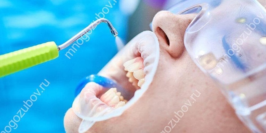 Почему кровоточат десны и как с этим бороться: рассказывают врачи