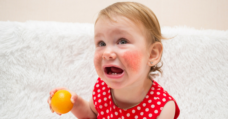 Чем лечить аллергию у ребенка? Причины, симптомы
