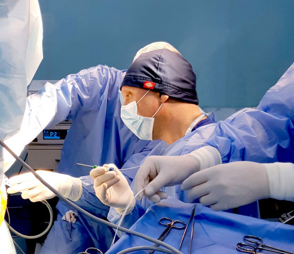 Плюсы лечить геморрой лазером