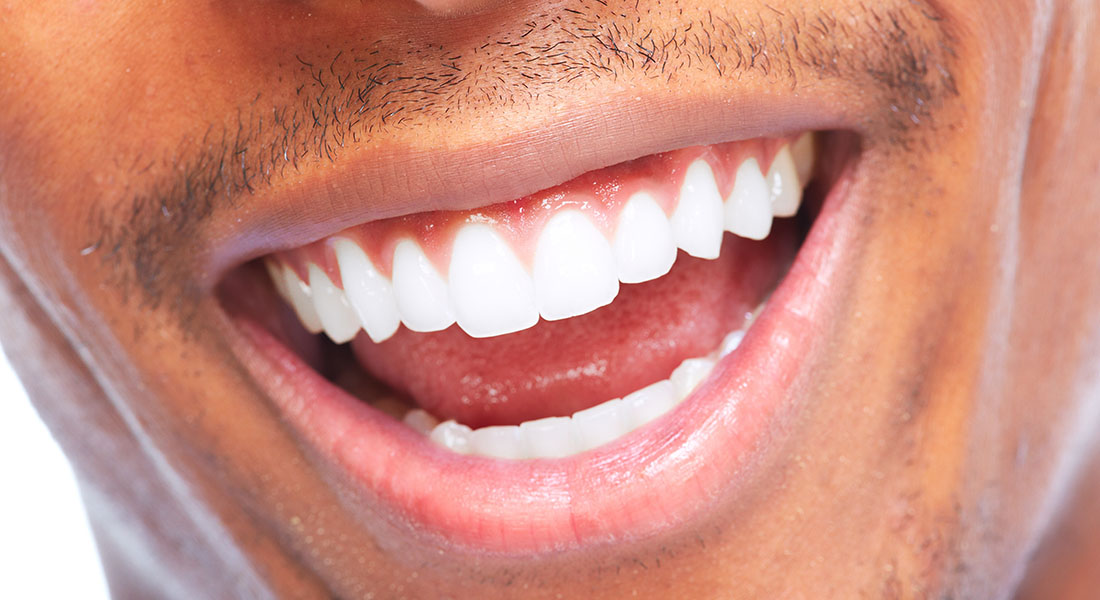 Как происходит установка имплантов