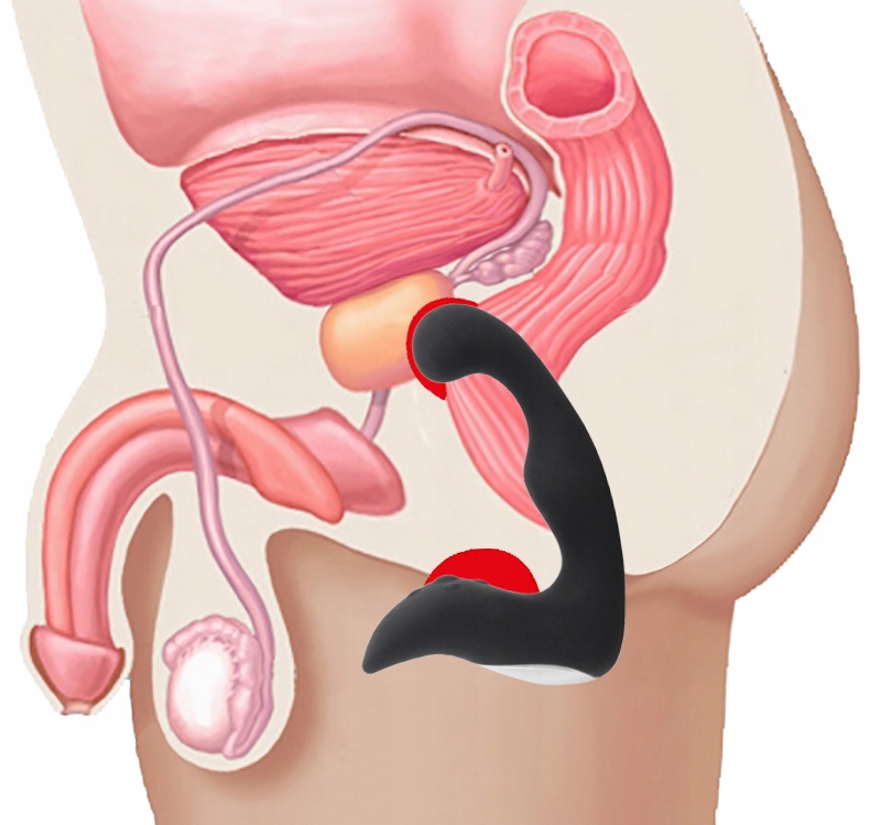 Чем полезен массажер простаты