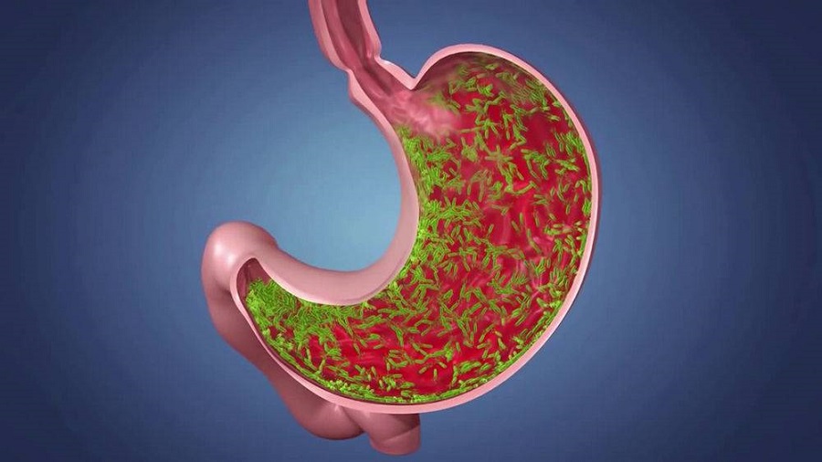 Причины и признаки гастрита