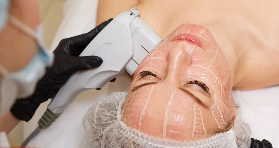 Особенности ультразвукового SMAS-лифтинга