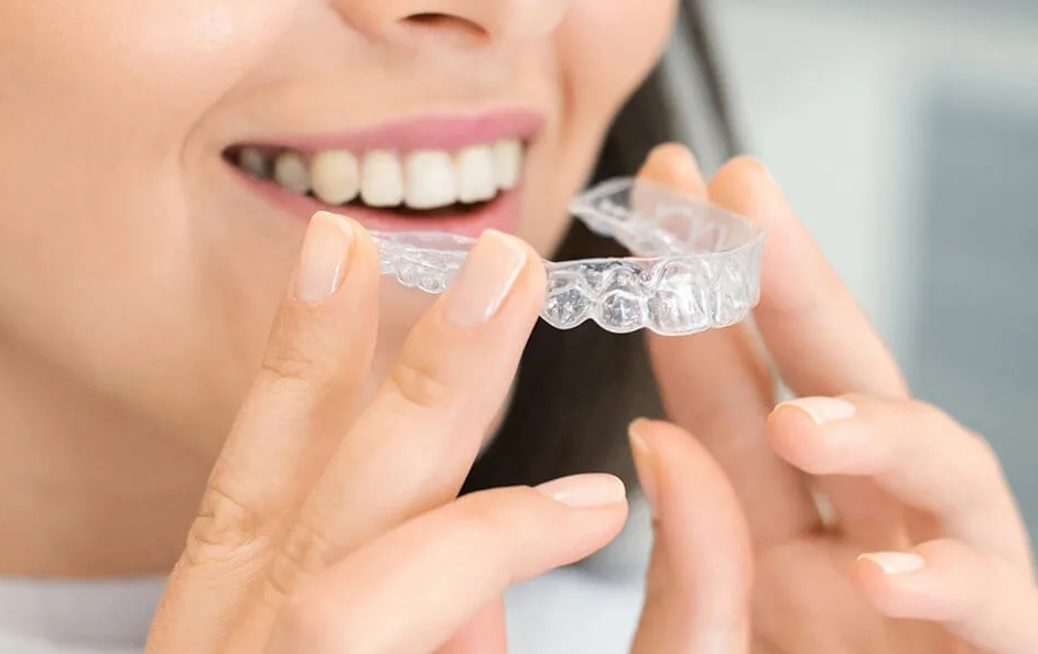 Что такое элайнеры и в чем их преимущества