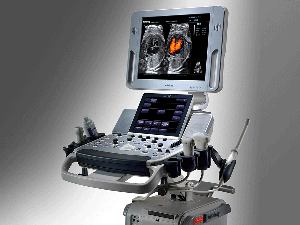 Как работает УЗИ аппарат