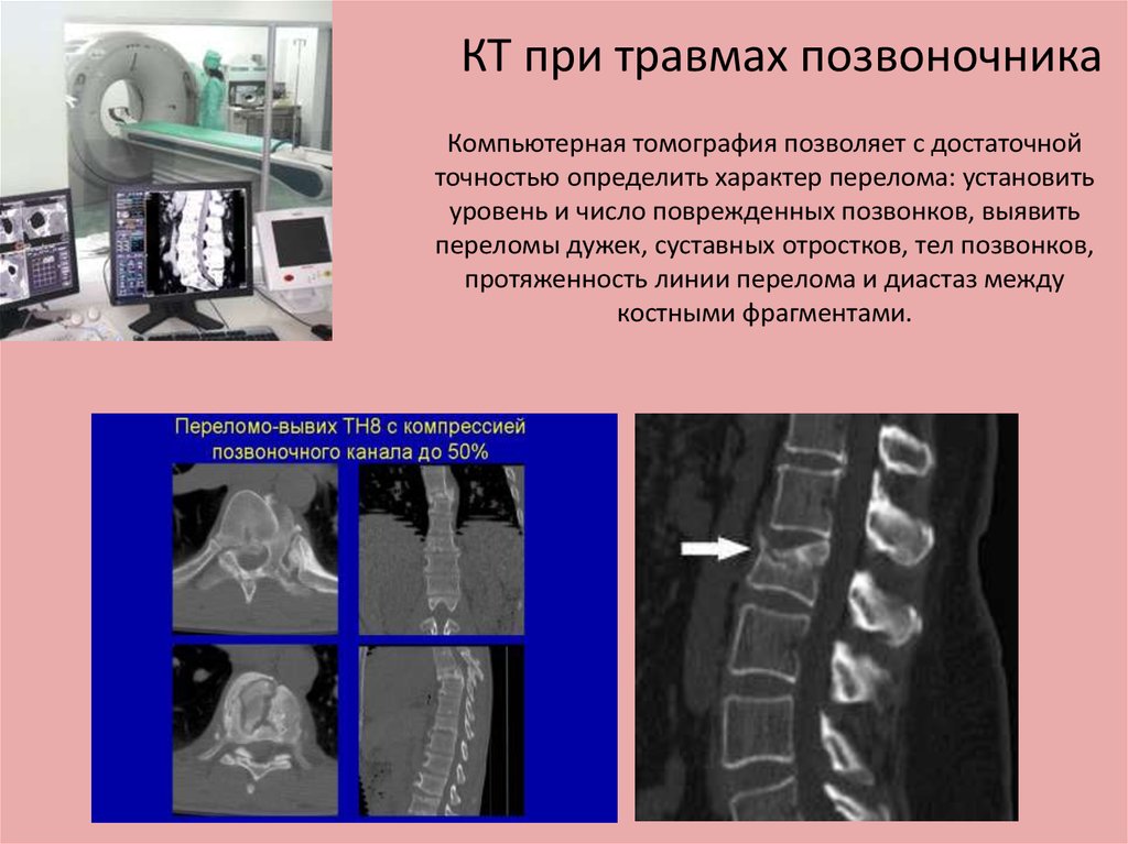 Диагностика заболеваний поясничного отдела позвоночника при помощи компьютерной томографии (КТ) в Украине