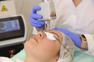 Лазерная шлифовка лица: ключ к идеальной коже
