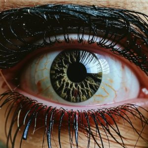 Как лечится катаракта?