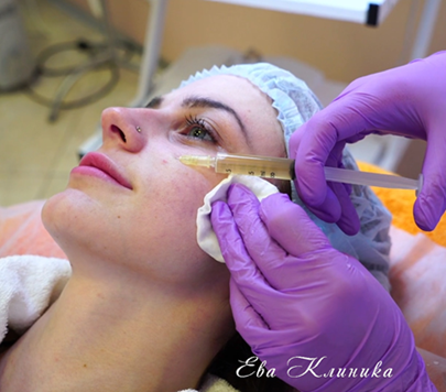 Плазмолифтинг: что это и зачем он нужен