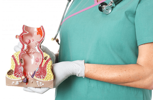 Когда стоит обратиться к врачу-проктологу: основные признаки и рекомендации