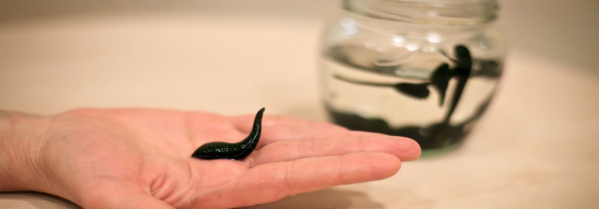 Цена лечения пиявками в Балашихе: насколько доступно эффективное восстановление без таблеток?