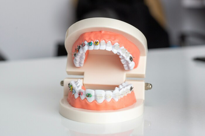 Улыбайтесь без комплексов - профессиональная помощь стоматолога рядом