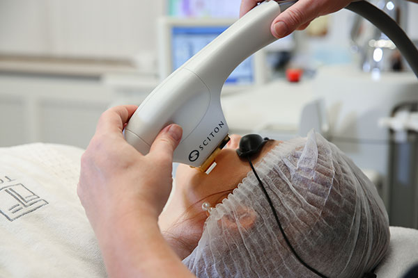 BBL-фотоомоложение: молодость кожи под контролем света