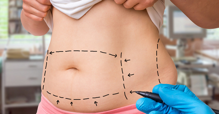 Процедура для тех, кто в деле: коррекция фигуры с Contourslim для активных женщин, у которых нет времени на долгий уход