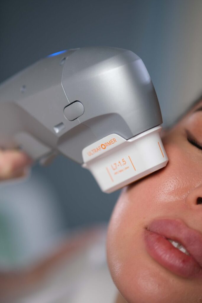 Векторный лифтинг: современная методика омоложения лица