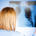 Лечение пневмонии народными средствами: рекомендации и самые популярные рецепты Заболевание пневмония