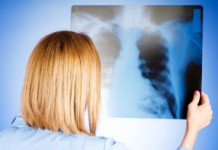 Лечение пневмонии народными средствами: рекомендации и самые популярные рецепты Заболевание пневмония