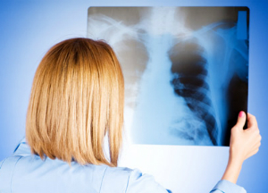 Лечение пневмонии народными средствами: рекомендации и самые популярные рецепты Заболевание пневмония