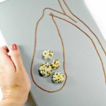 Что делать, если в желчном пузыре камни: лечение народными средствами Камни в желчном