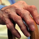 Полиартрит пальцев рук: эффективное лечение народными средствами Полиартрит пальцев рук