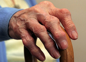 Полиартрит пальцев рук: эффективное лечение народными средствами Полиартрит пальцев рук