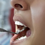 Лечение пародонтоза самыми эффективными народными средствами: лучшие рецепты и способы Пародонтоз