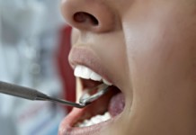 Лечение пародонтоза самыми эффективными народными средствами: лучшие рецепты и способы Пародонтоз