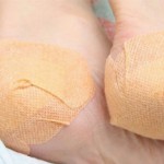 Эффективное лечение шпоры на пятке народными средствами Шпора на пятке