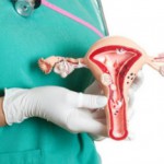 Полипы в матке: симптомы и лечение народными средствами Полипы в матке