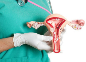 Полипы в матке: симптомы и лечение народными средствами Полипы в матке