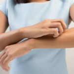 Лечение чесотки в домашних условиях: самые лучшие народные средства Чесотка