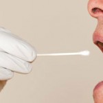 Флюс на десне: причины появления образования и лечение в домашних условиях Флюс на десне