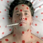 Быстрое лечение ветрянки у взрослых в домашних условиях Ветрянка у взрослых