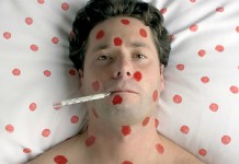 Быстрое лечение ветрянки у взрослых в домашних условиях Ветрянка у взрослых